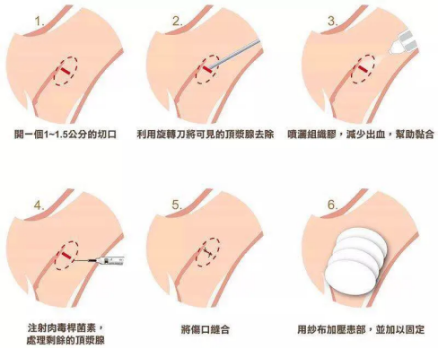 1637136058105797.png image.png